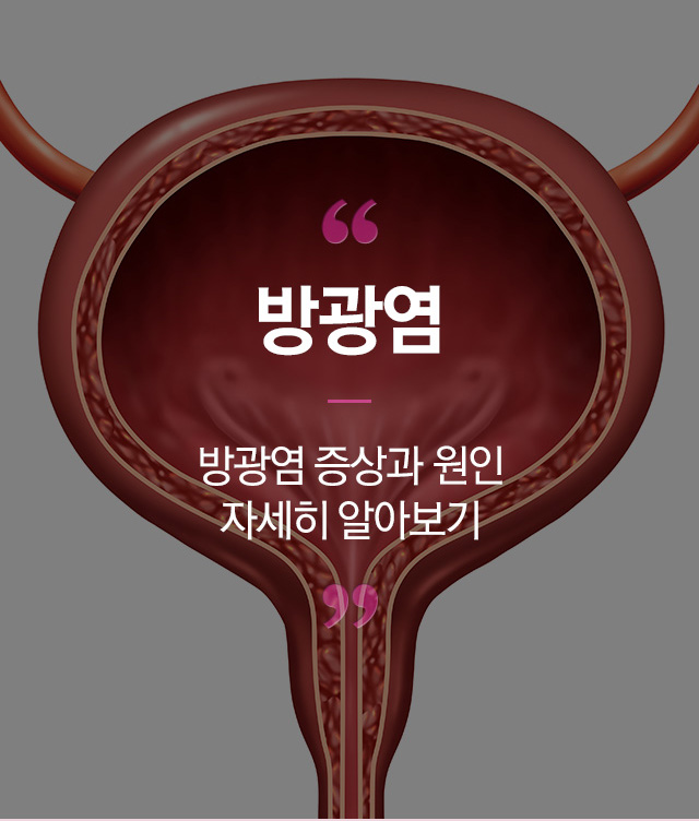 방광염 - 로앤산부인과