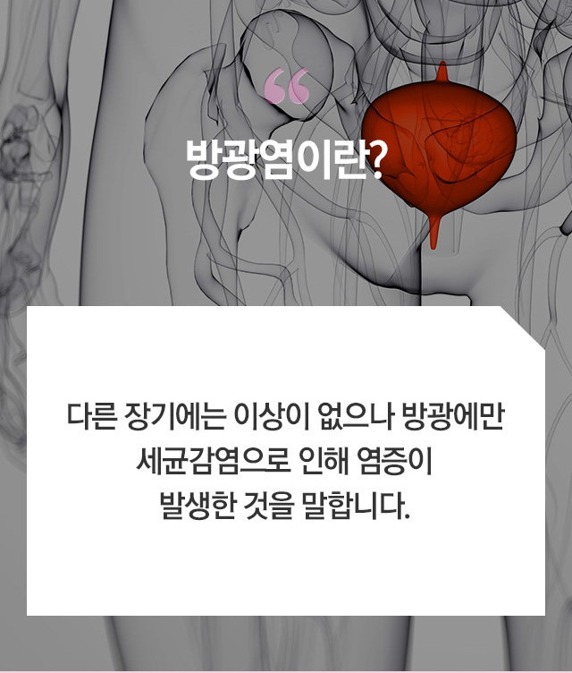 방광염 - 로앤산부인과